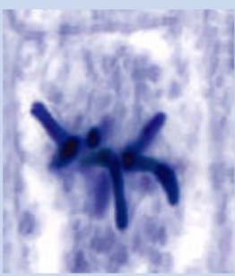 <p>Name this Mitosis Phase (Onion Root)</p>