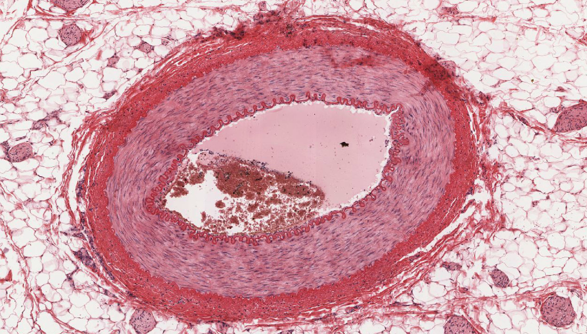 <p>What histological slide is this for?</p>