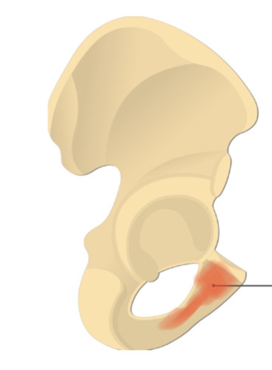 <p>enlarged, medial portion of the pubis region of the hip bone</p>