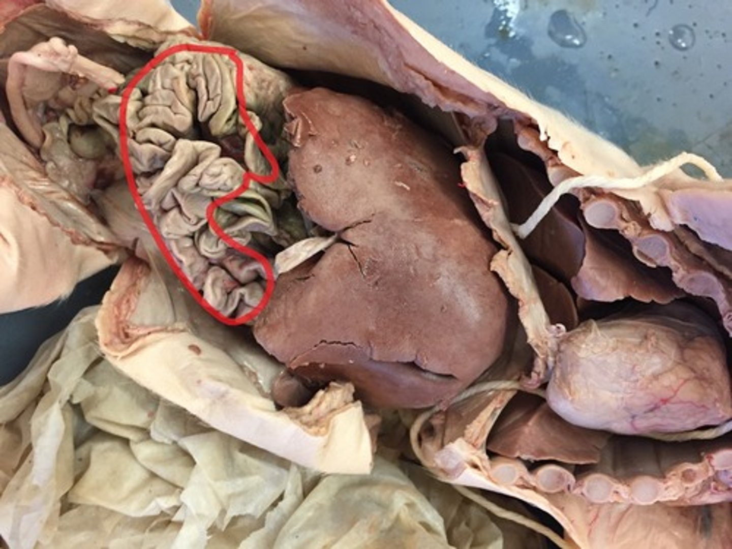 <p>Digestive organ where most chemical digestion and absorption of food takes place</p>