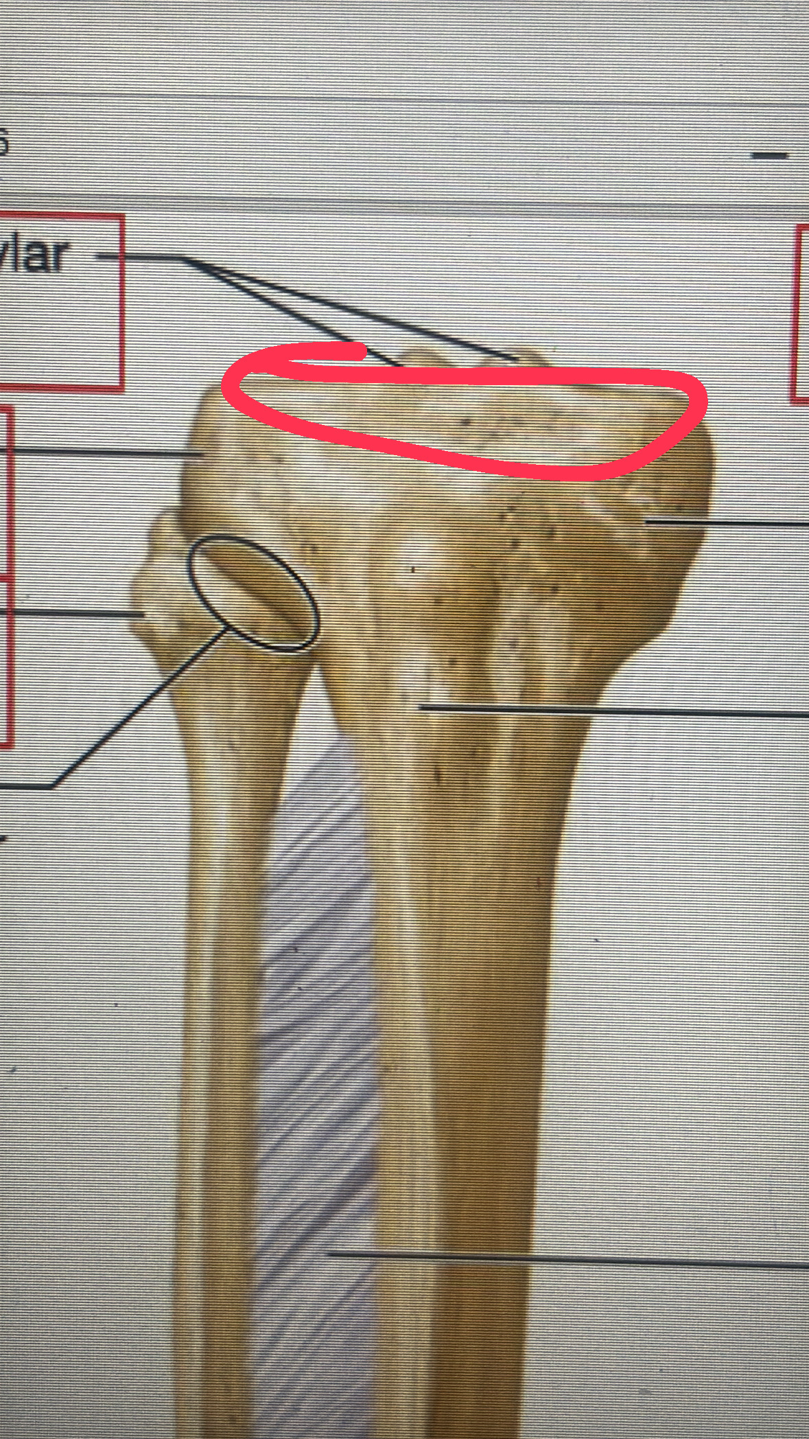 <p>on top of the tibia</p>