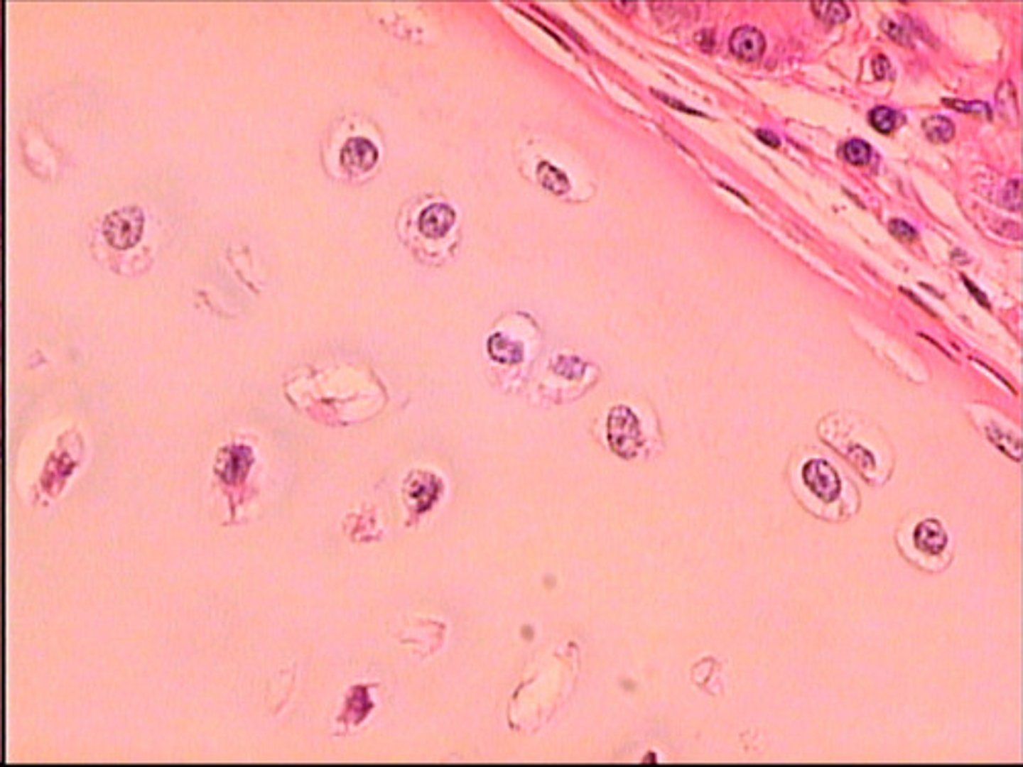 <p>cell has homogeneous matrix (same throughout, glassy)</p><p>chondrocyte in lacuna</p><p>found in articulating surfaces of bones (joint surface)</p><p>nasal cart.</p><p>costal cart (attach ribs to sternum)</p><p>trachea &amp; bronchi (hold trac/bronch open)</p><p>entire embryonic skeleton</p>