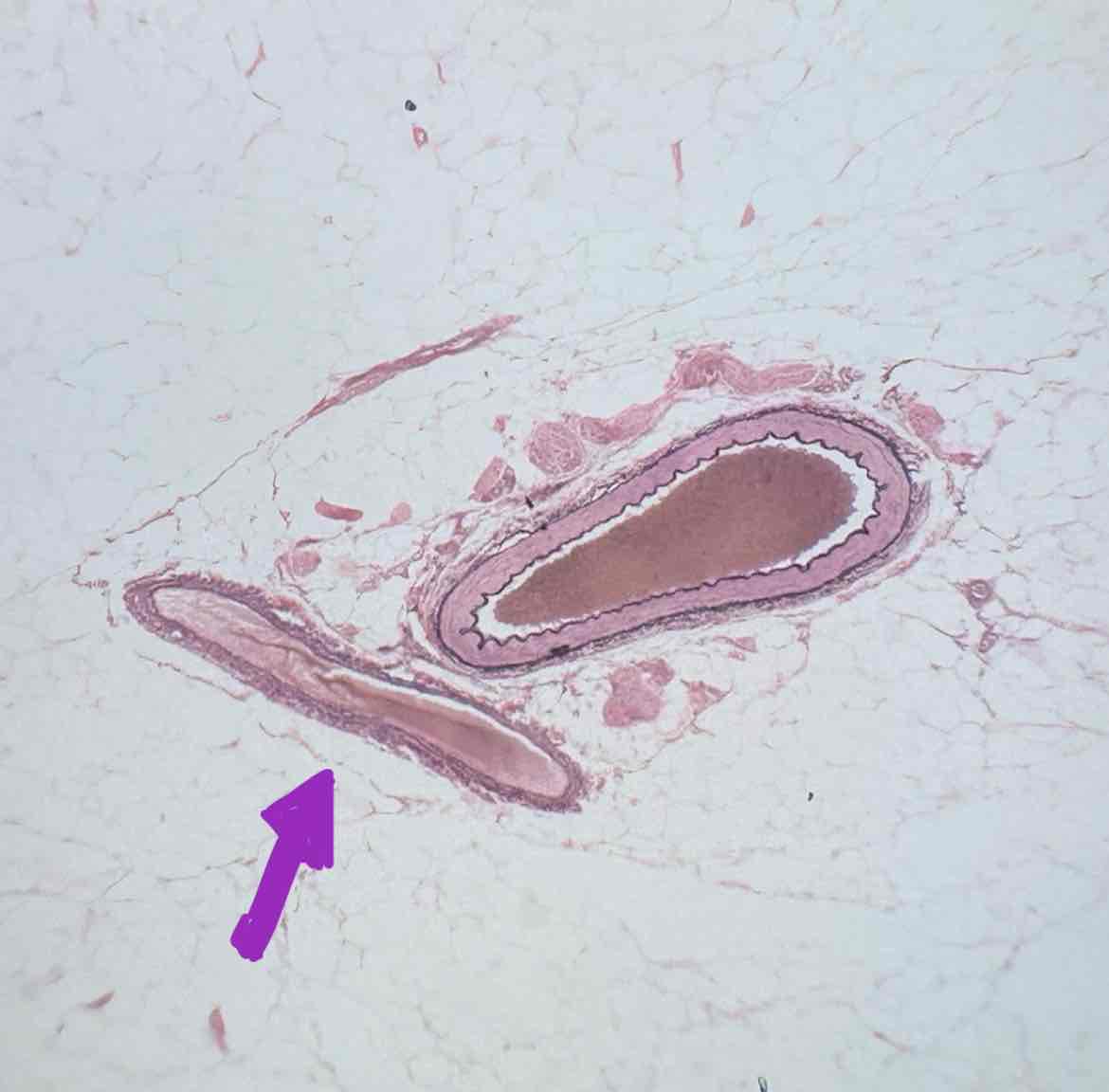 term image