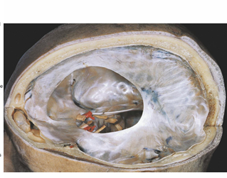 <p>Identify roughly where the superior sagittal sinus, inferior sagittal sinus, straight sinus, transverse sinus, and confluence of sinuses are located </p>