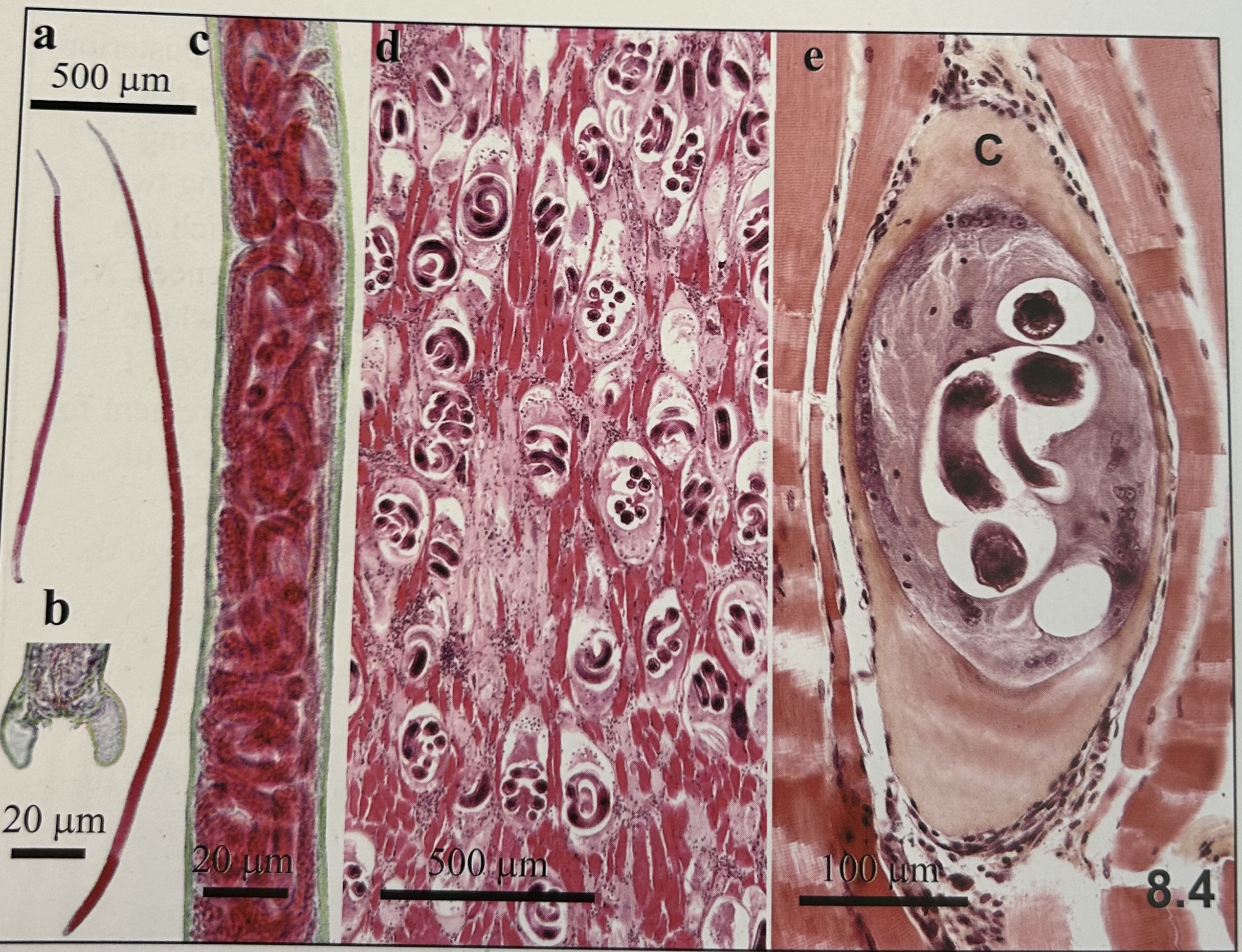 <p>characteristics of</p><p>Trichinella spiralis (adult in intestinal mucosa)?</p>