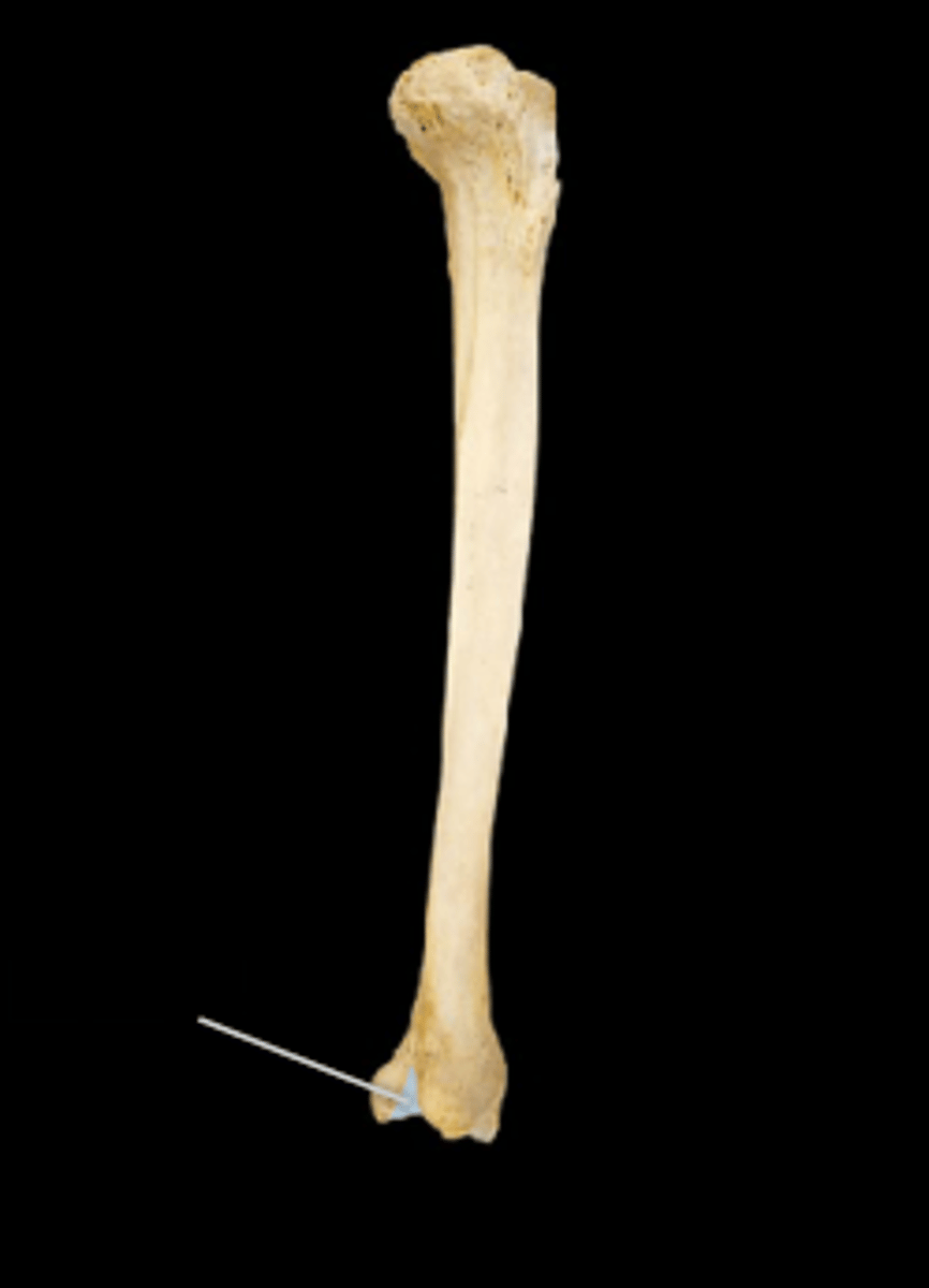<p>Small notch at the distal end on the lateral side of the tibia that articulates with the fibula</p>