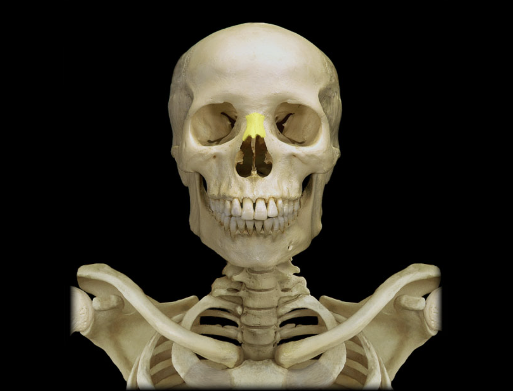 <p>Nasal bone</p>