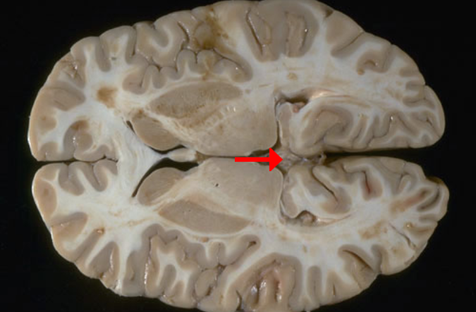 <p>Label this brain structure</p>