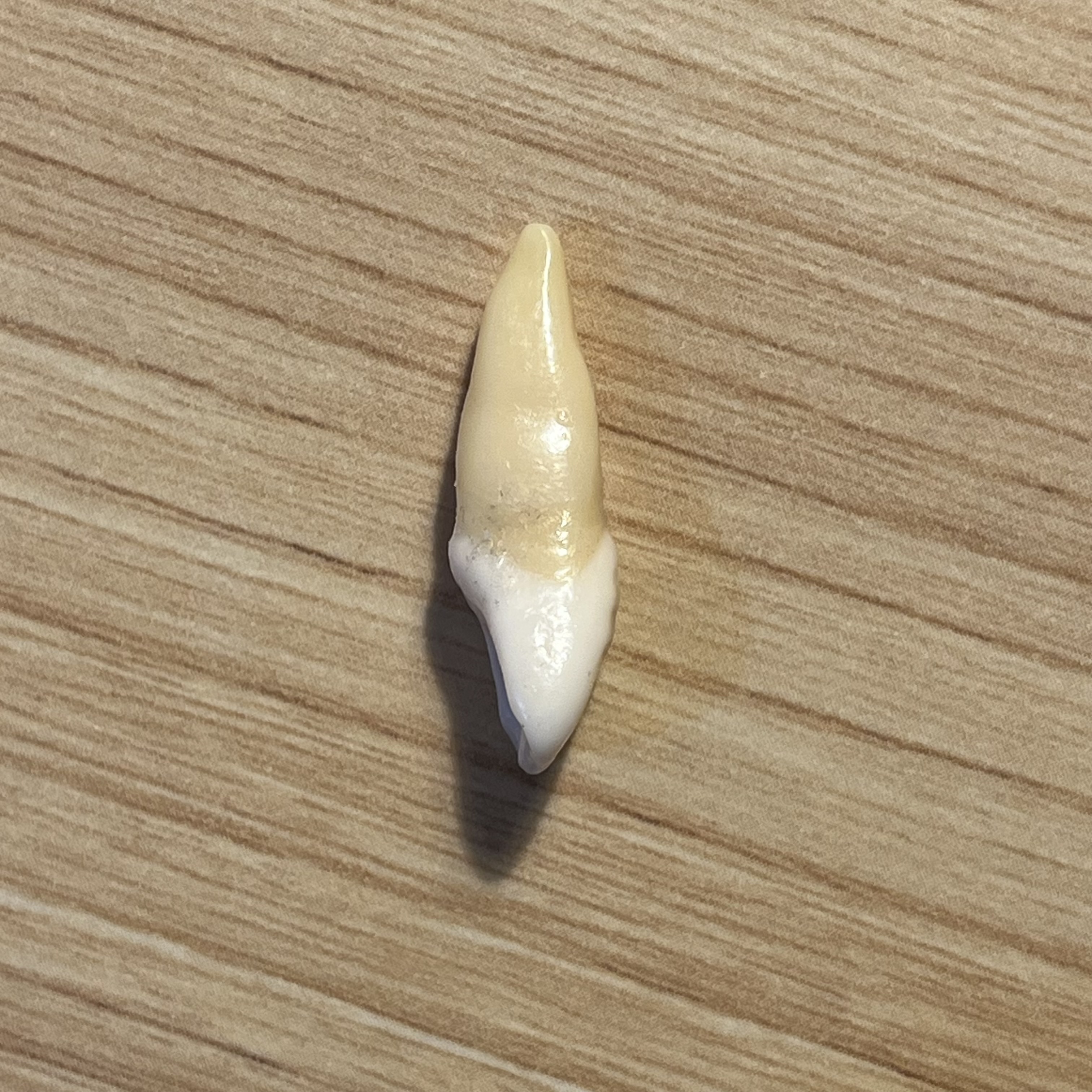 <p>What tooth is this (with view)?</p>