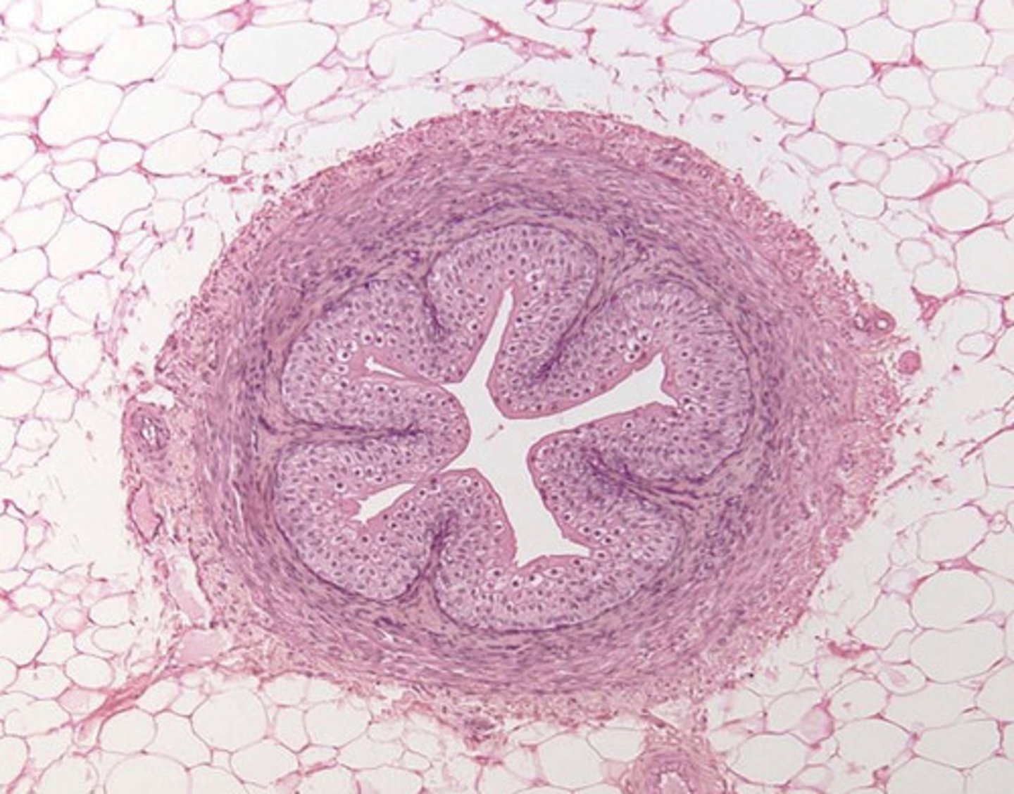 <p>the ureter is surrounded by what type of tissue?</p>
