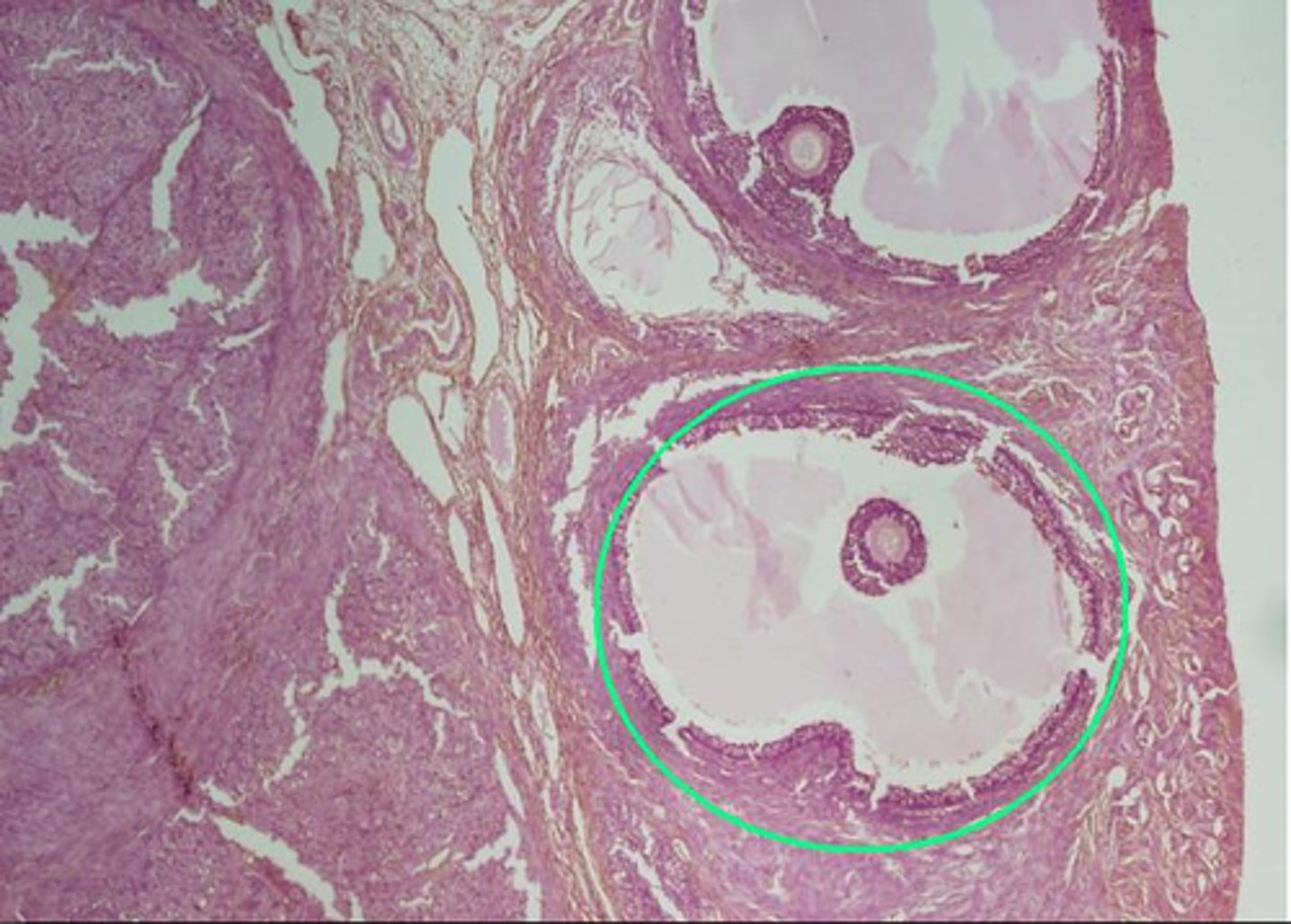 <p>What hormone producing cells are found in the indicated region within the ovary?</p>