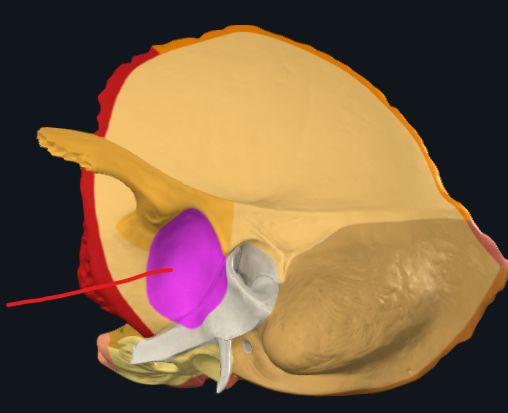 <p>jamka <strong>čelistního kloubu </strong>pro <strong>hlavici mandibuly</strong></p>