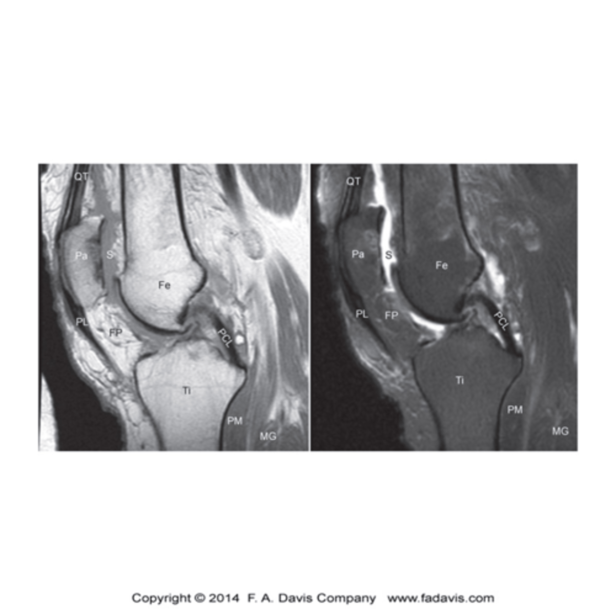 <p>- Cortical Bone</p><p>- Ligaments and Tendons</p>