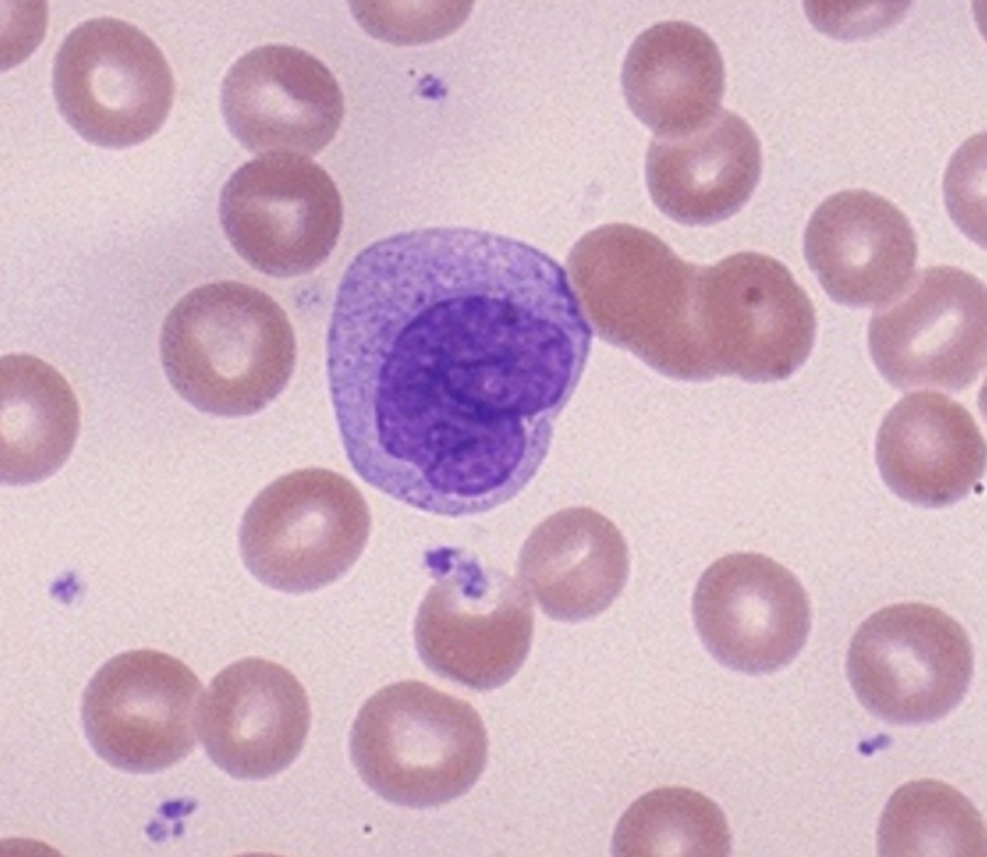 <p>What is the center cell?</p>