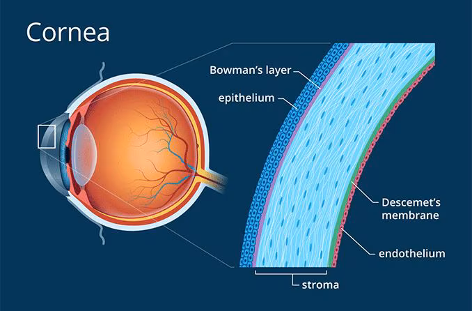 <p>The endothelium and stroma of the cornea.</p>