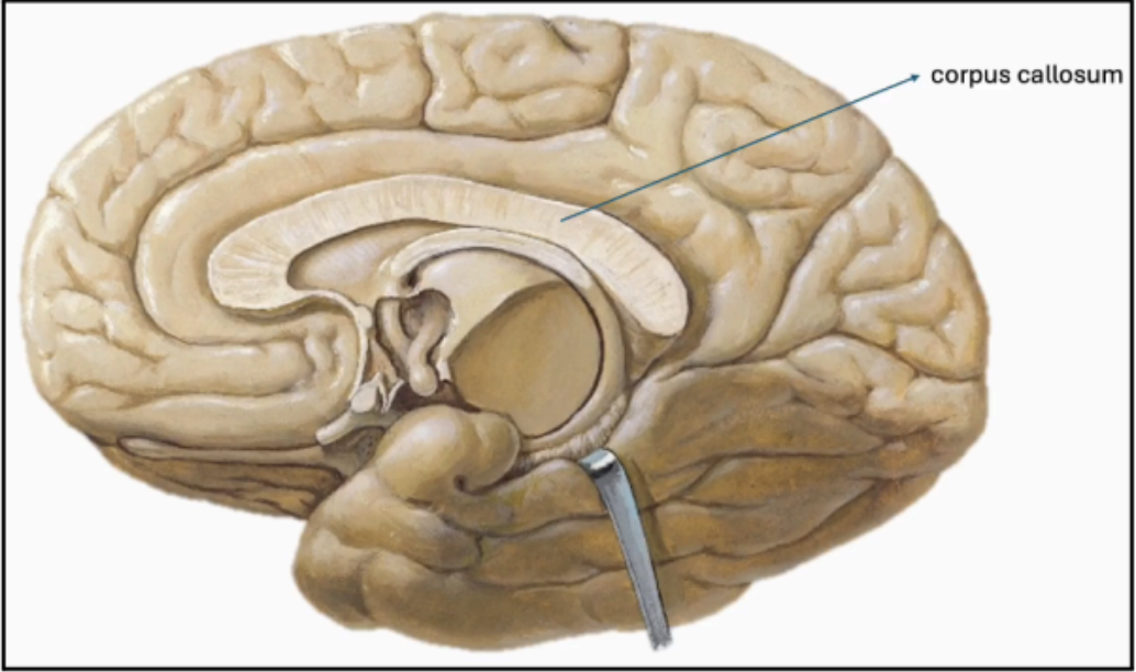 <p>Corpus Callosum</p>