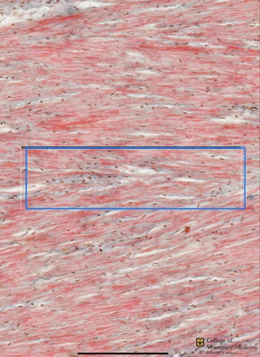 <p>What cartilage type is depicted?</p><p>What is the tissue type stained blue?</p>