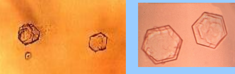 <p>What are these?</p>