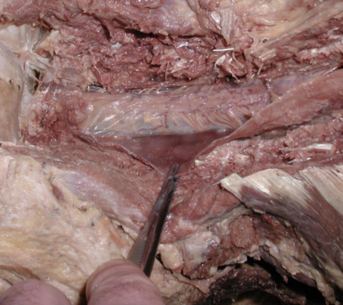 <p>= vláken (fila radicularia)</p><p>- ze sulcus ventrolateralis a dorsolateralis</p>