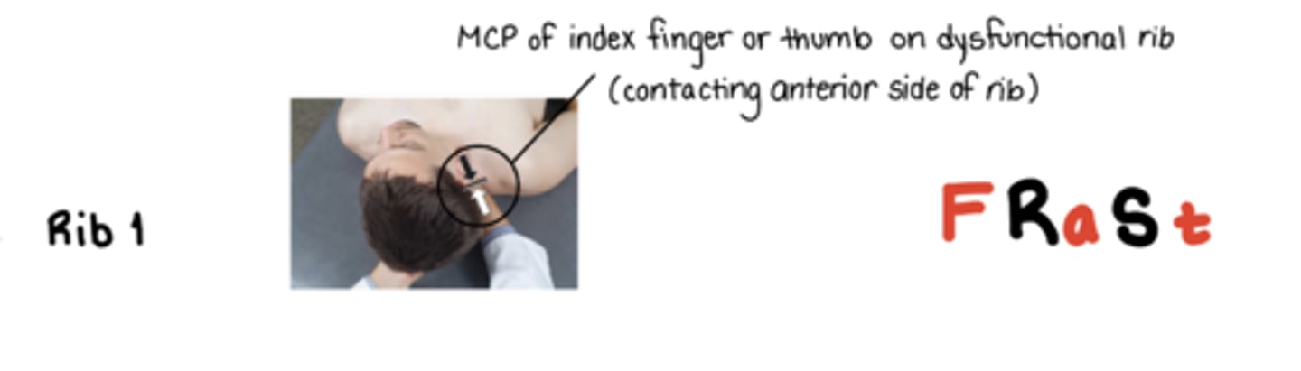 <p>F Ra St</p><p>MCP of index finger or thumb on dysfunctional rib contacting anterior side of rib - resisting with INHALATION, following into EXHALATION</p>