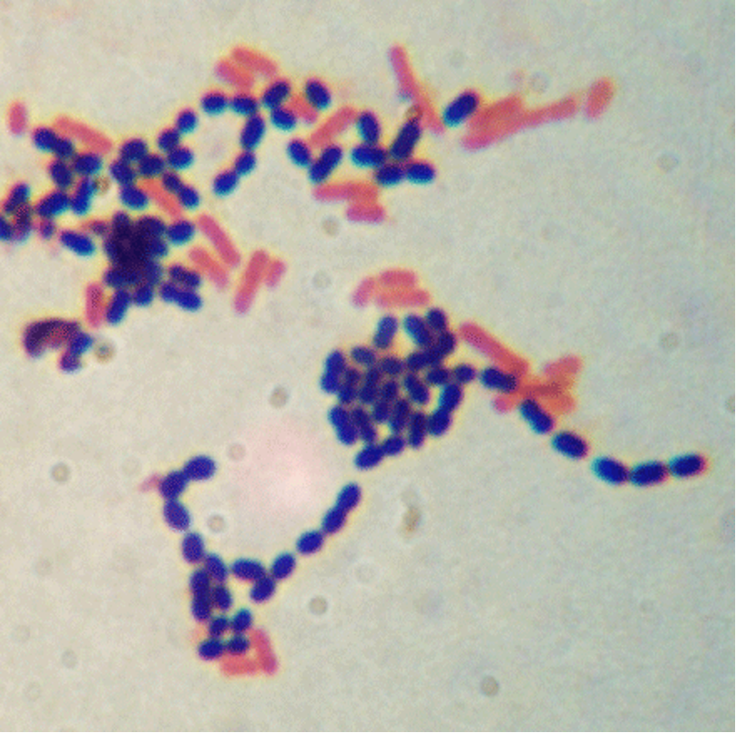 <p>Which cells are Gram positive (in Gram stain)</p>