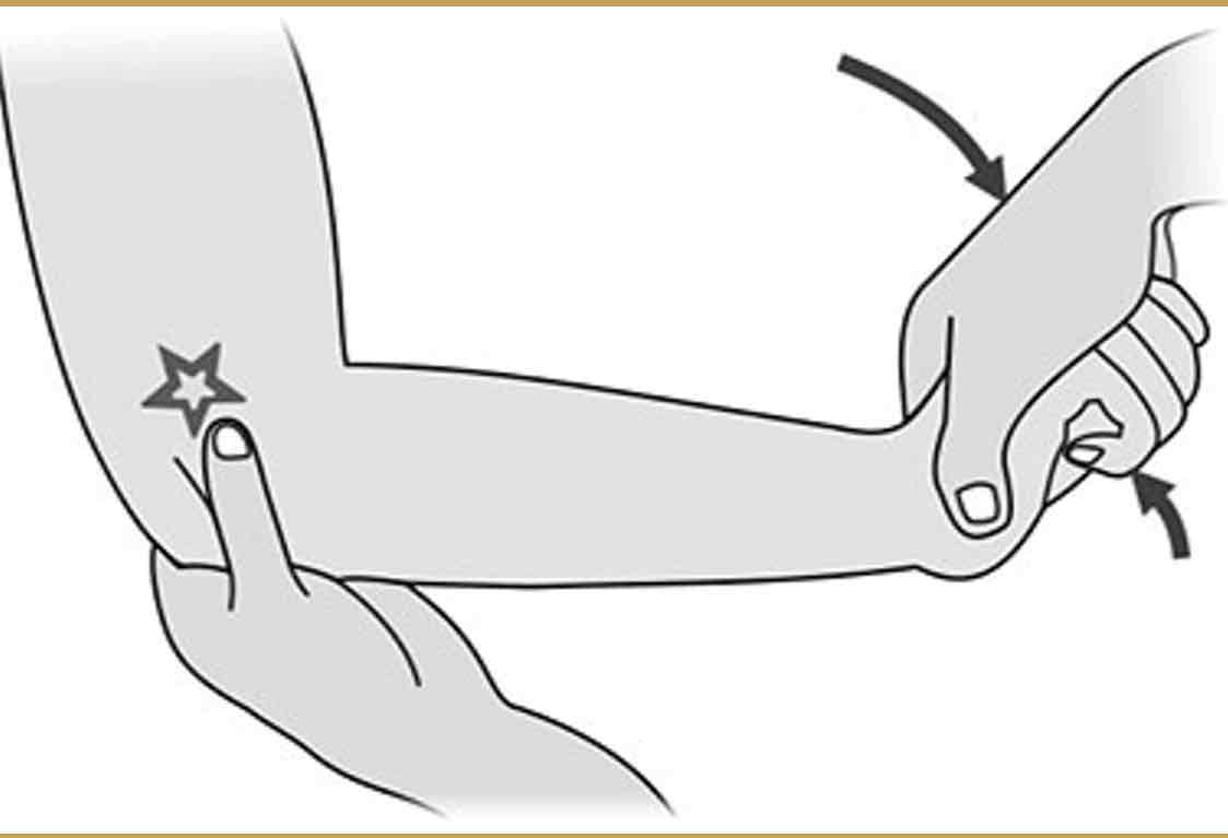 <p><strong>Purpose: </strong>To assess for tendinosis of the common extensor tendon. Test for Tennis elbow.</p><p></p><p><strong>Steps:</strong></p><p>1.The client is seated, with the elbow in 90 flex, the wrist in pronation and slight extension.</p><p>2.The therapist stabilizes the client’s elbow with one hand while placing the thumb on the lateral epicondyle.</p><p>3.The therapist asks the client to extend the wrist against the therapist resistance.</p><p><strong>Result: </strong>A positive test is pain local to the common extensor tendon.</p>