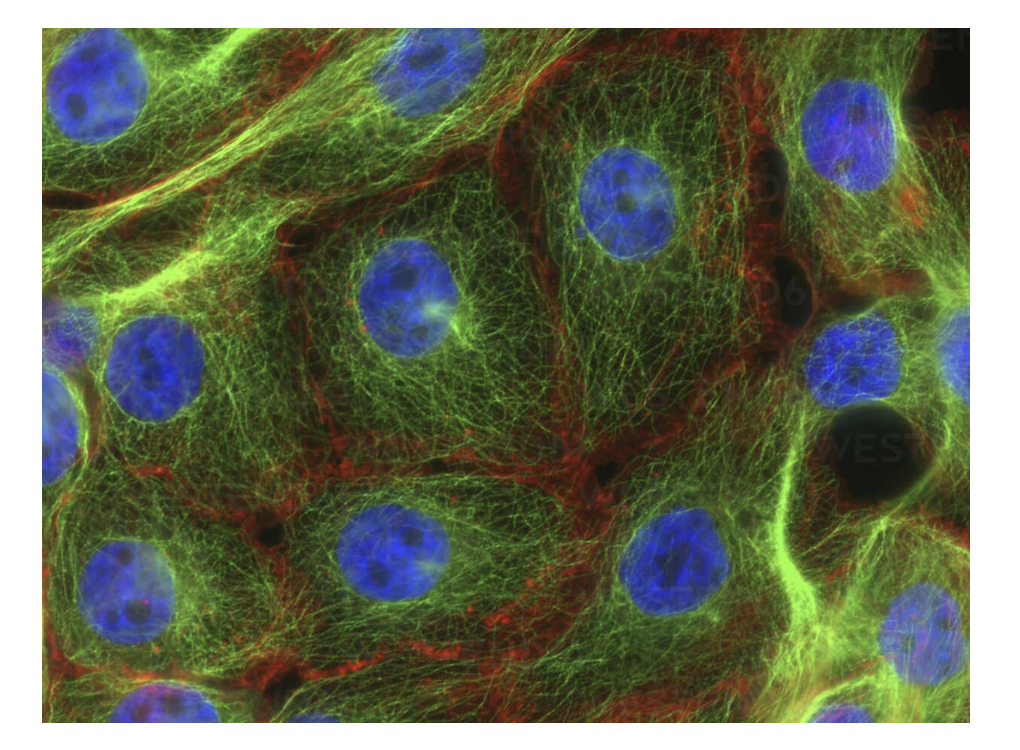 <p>Look at this image of stress fibers in human breast cancer cells and identify DAPI, GFP and RFP</p>