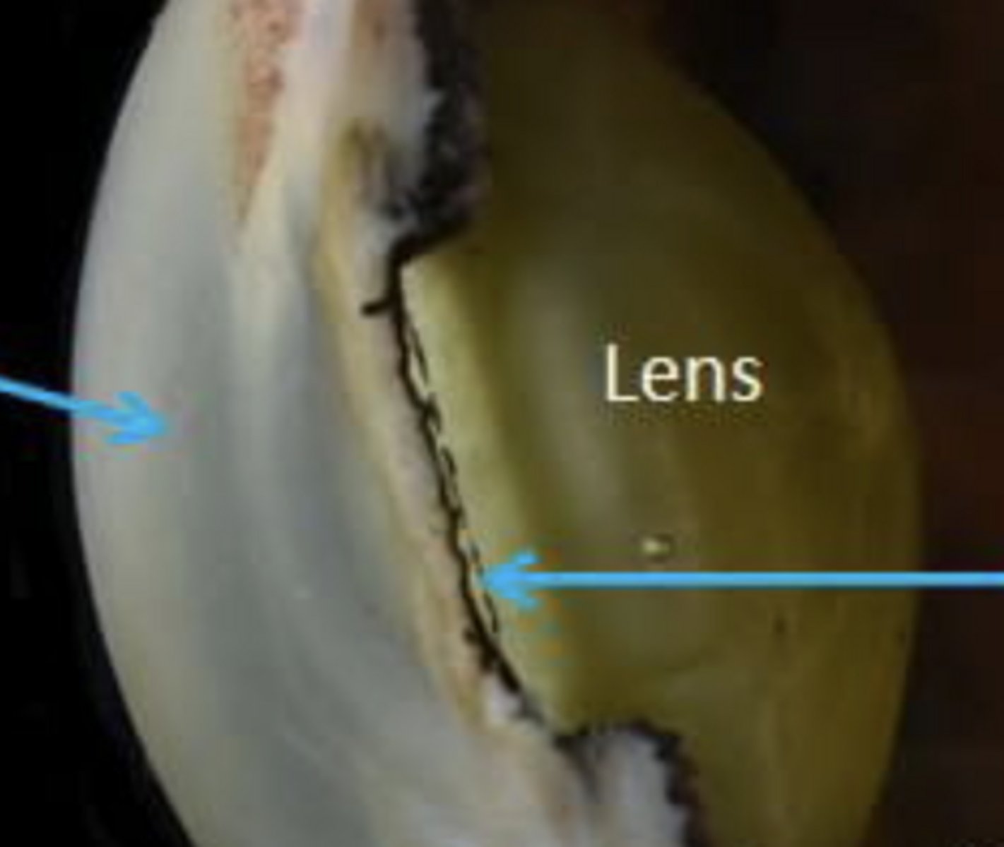 <p>Added lens just because it's not on the actually eyes in lab.</p><p>Bulby looking area on the inside of the eye</p>