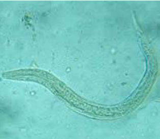 <ul><li><p><span><u>Long buccal cavity</u></span></p></li><li><p><span>More than the width of the body</span></p></li><li><p><span>Genital primordium NOT visible</span></p></li><li><p><span>Esophagus is bulbed</span></p></li></ul><p></p>