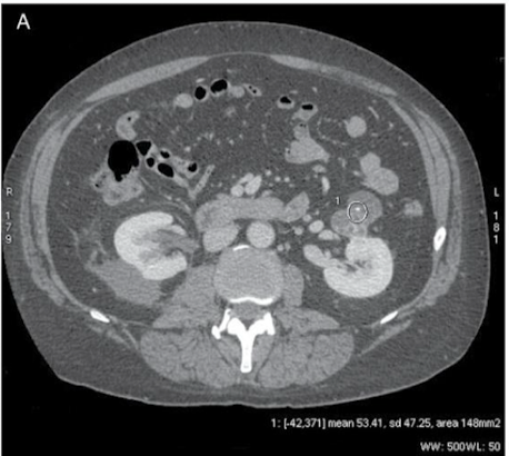 <p>Why is this ROI not appropriate?</p>