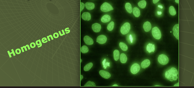<p>anti-histone</p>