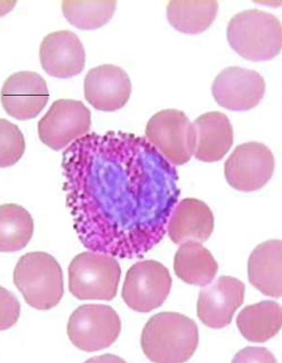 <p>Which leukocyte?</p>