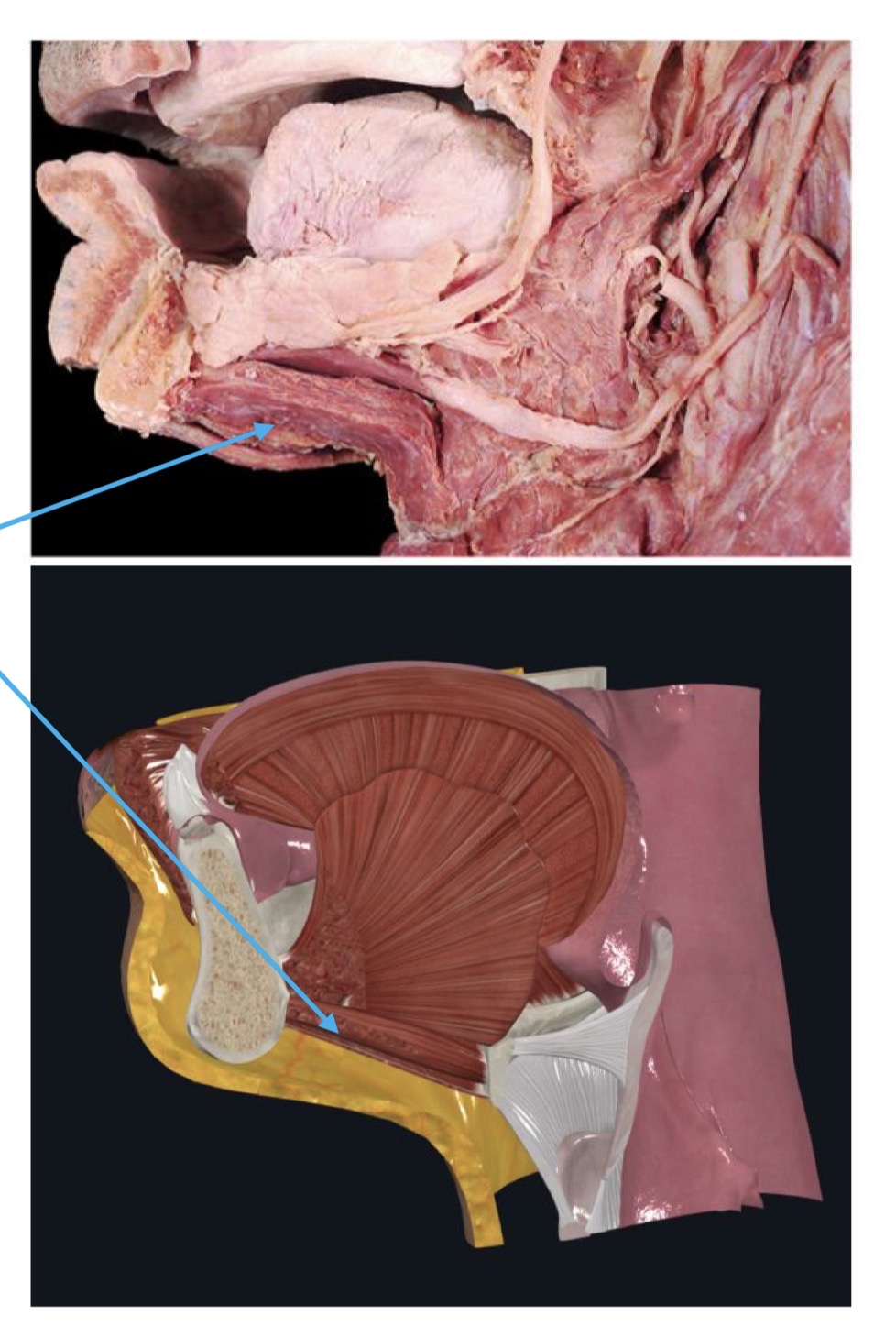 <p>Oral cavity floor</p>