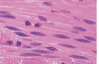 <p>Smooth Muscle Tissue</p>