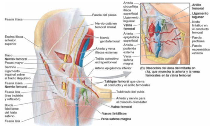 <p>¿Qué pasa cuando la vaina femoral se extiende más distalmente (mas larga)?</p>