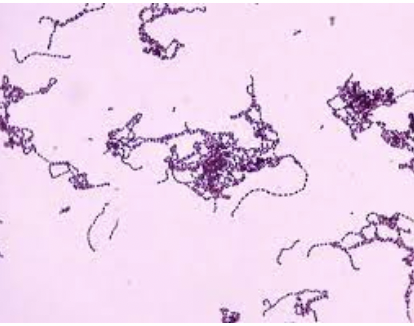 * forms tiny colonies less than 1 mm wide
* transparent, barely off-white in color
* stains as a Gram-positive coccus
* common in nose and mouth
* cause of "strep throat"