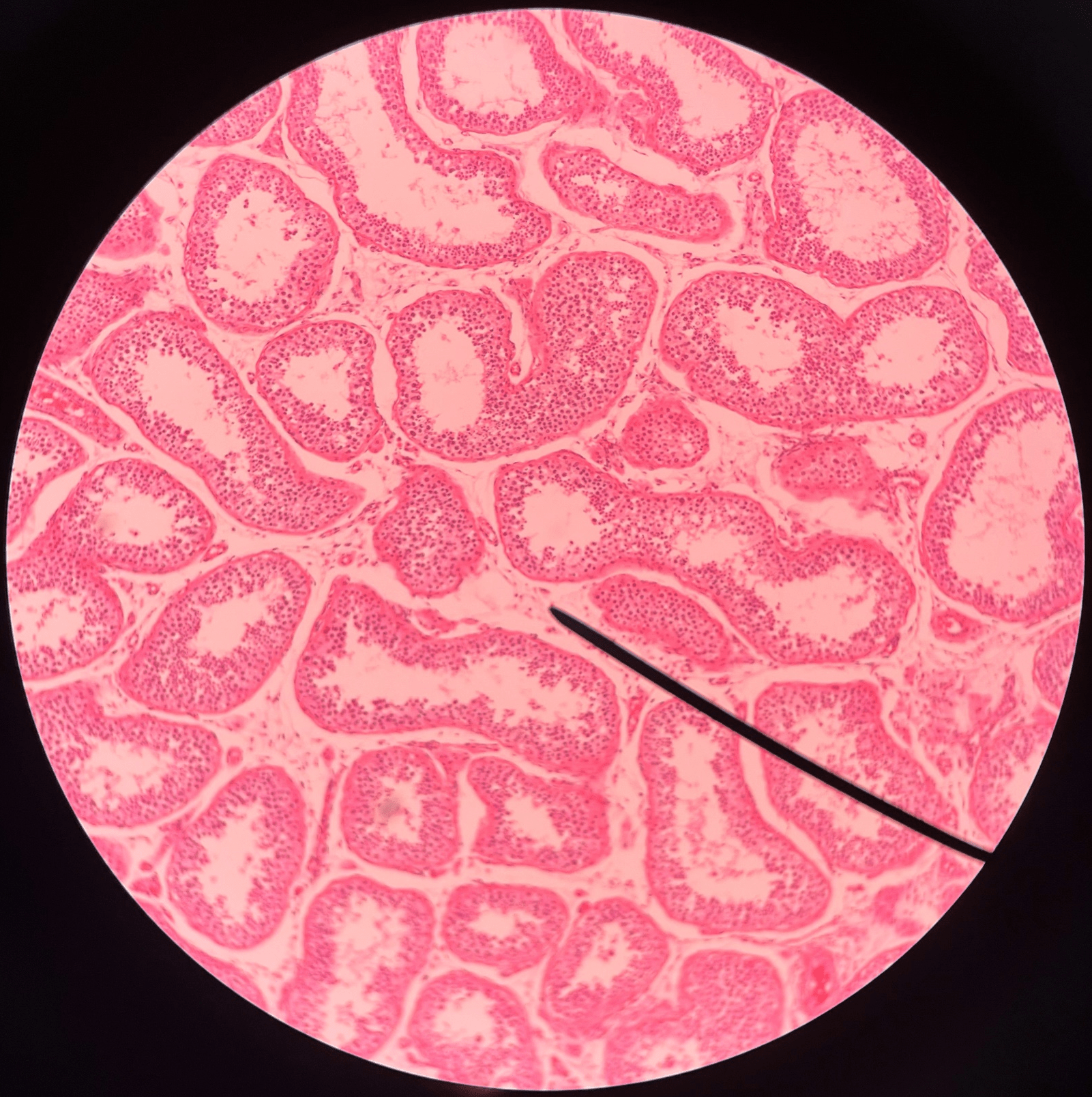 • Slide histology of the testis.

• Located between the seminiferous tubules.

• Secretes testosterone.

• Also known as cells of Leydig.
