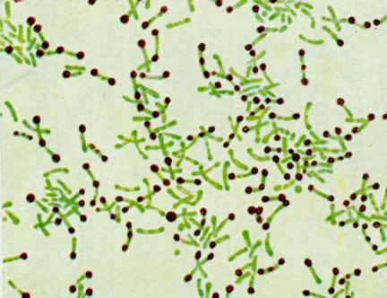 Corynebacterium diphtheriae
