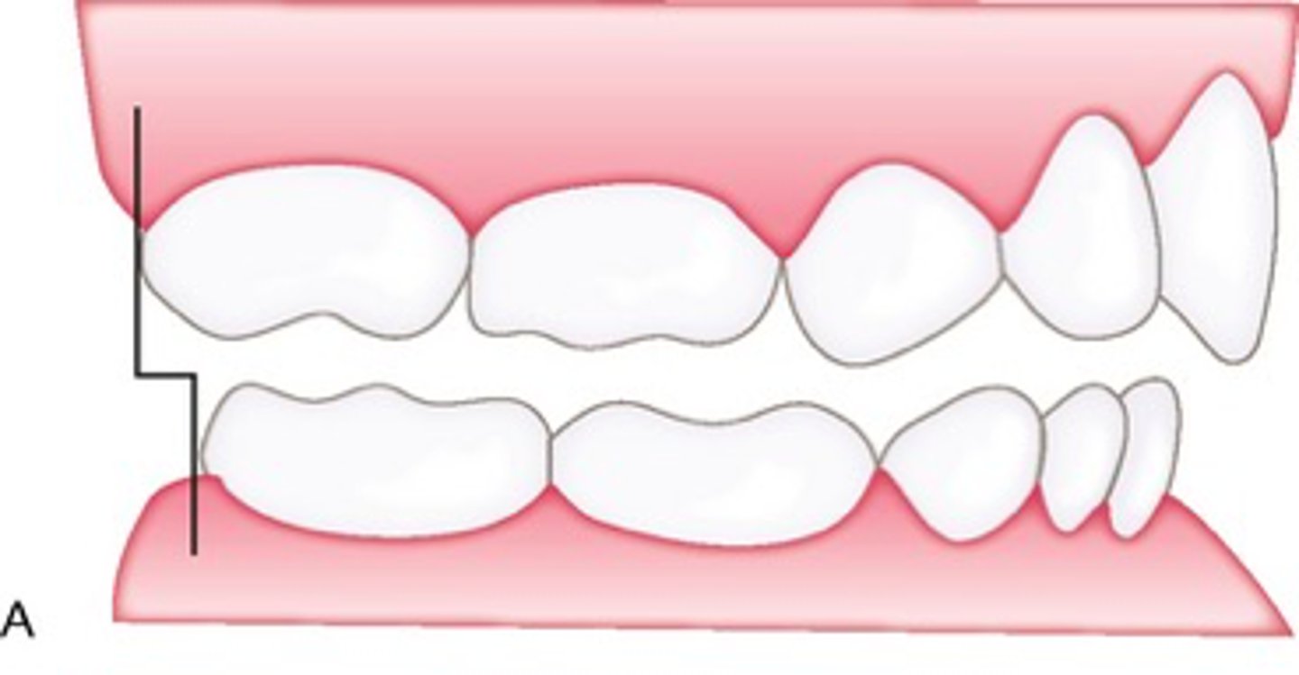 <p>ID the terminal plane:</p>