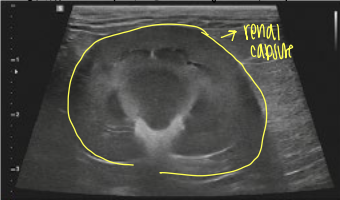 <p>what view is this ultrasound of the kidneys?</p>