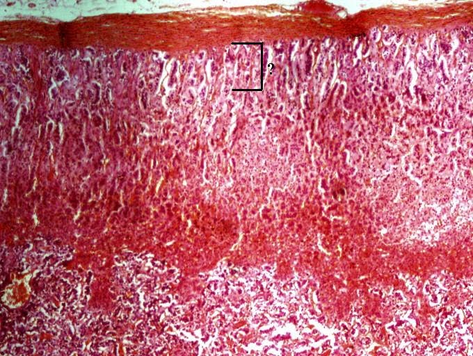 <p><span>Identify the indicated layer of the adrenal gland.</span></p>