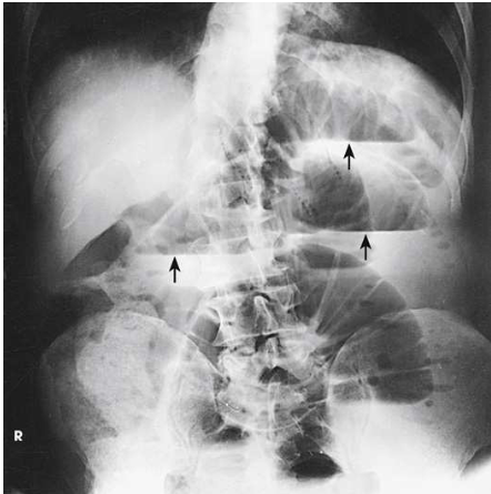 <p>What projection, position and anatomy is this?</p>