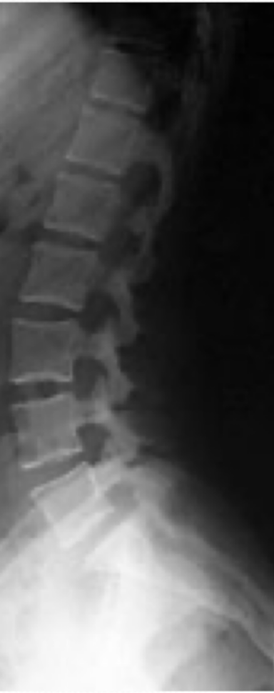 <p>Which part of the spine is this image of?</p>