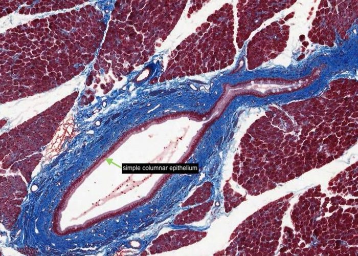 Pancreas - large interlobular duct (Trichome)