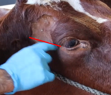 <ul><li><p>Dorsal border of the zygomatic arch then below the eye</p></li><li><p><span style="font-family: &quot;Comic Neue&quot;, cursive">Halfway btw lat canthus of eye and the ear along dorsal zygo arch (go superficial with it)</span></p></li></ul><p></p>