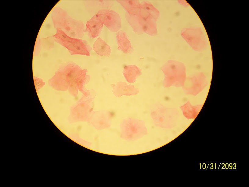 <p>Simple Squamous Epithelium</p>