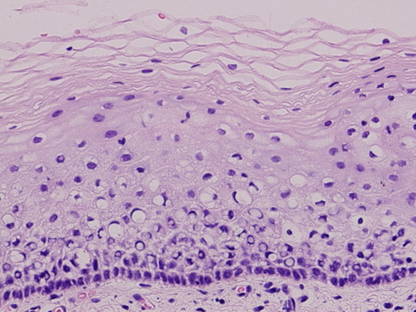 <p>Stratified Squamous</p>