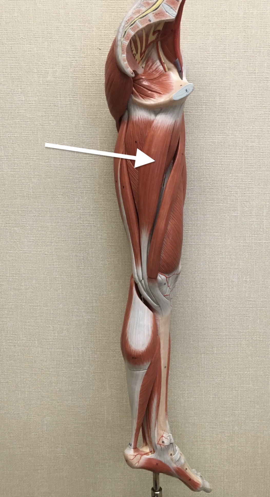 <p><span>Name the muscle labeled with the white arrow below:</span></p>