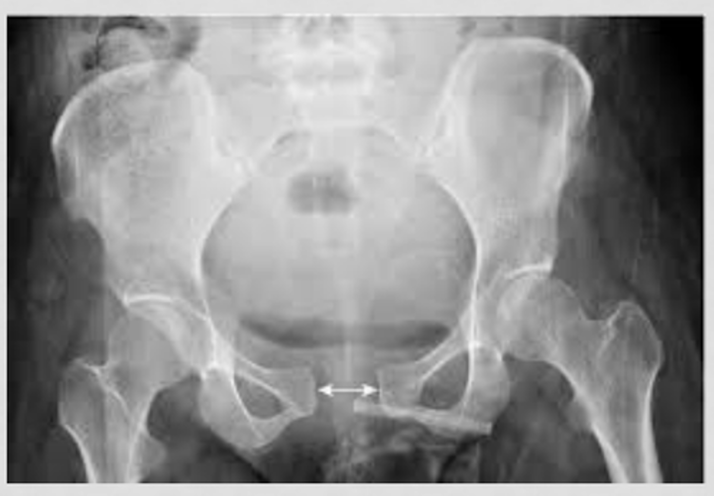 <p>What pathology is this?</p>