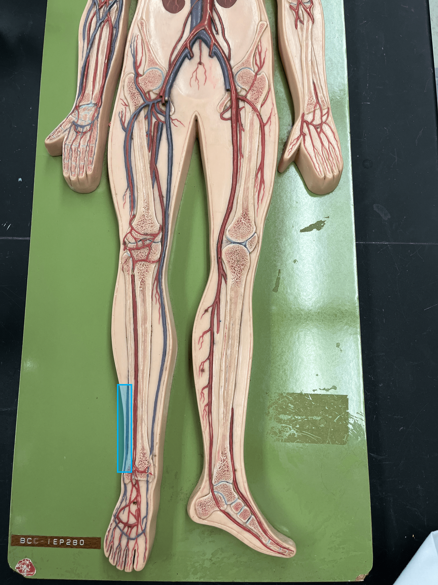 <p>• A vein of the lower limb.</p>
<p>• Drains the lateral lower leg.</p>
<p>• Empties into the popliteal vein.</p>